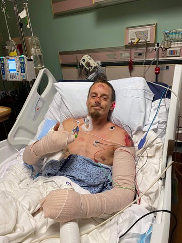 Dahlonega man recovering from injuries suffered while ...
