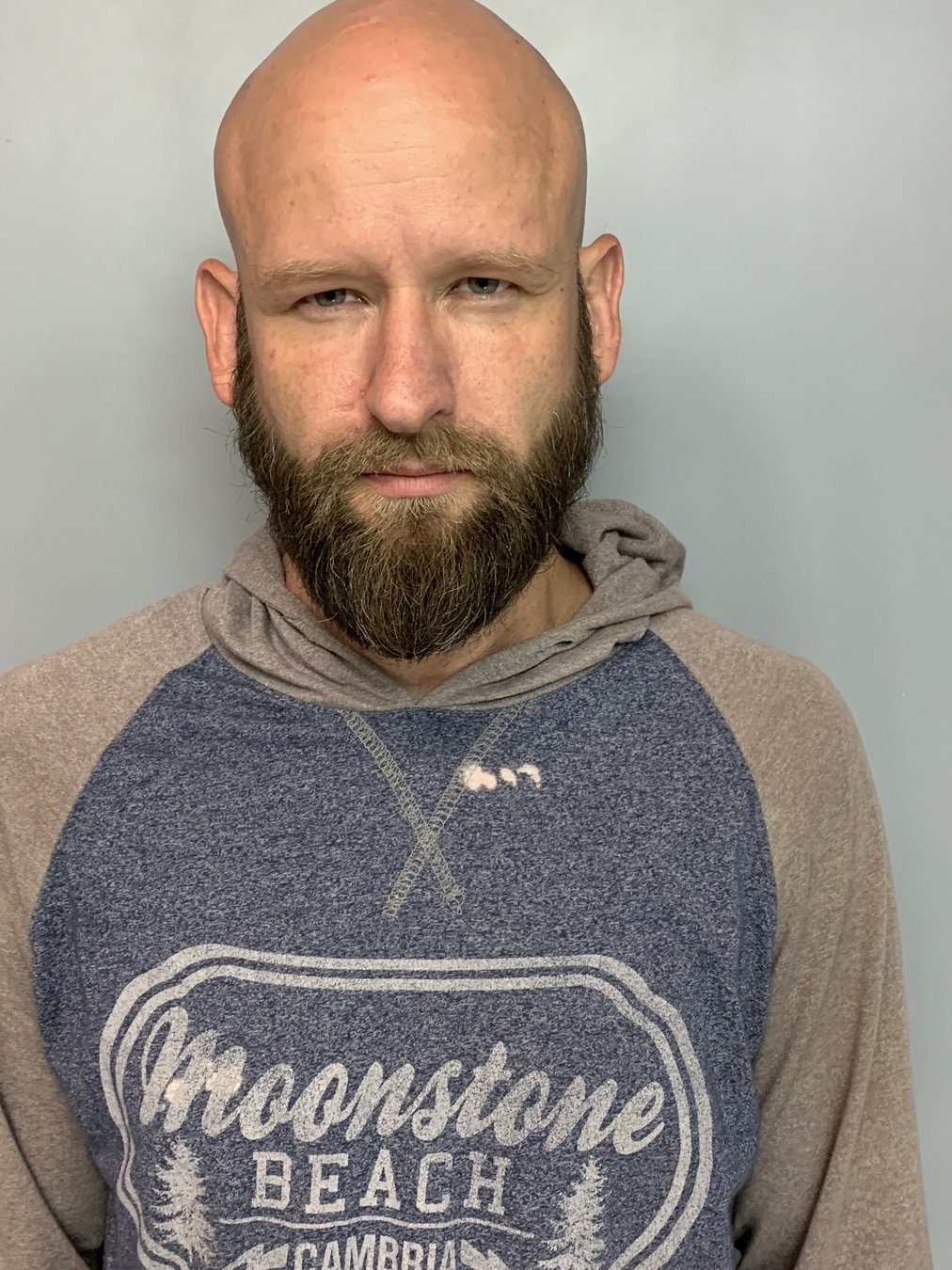 Man charged in milliondollar meth cases suffered brain hemorrhage in